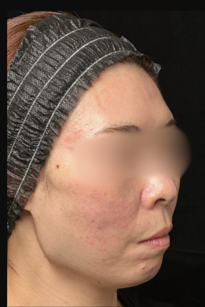 手術前の状態 その1