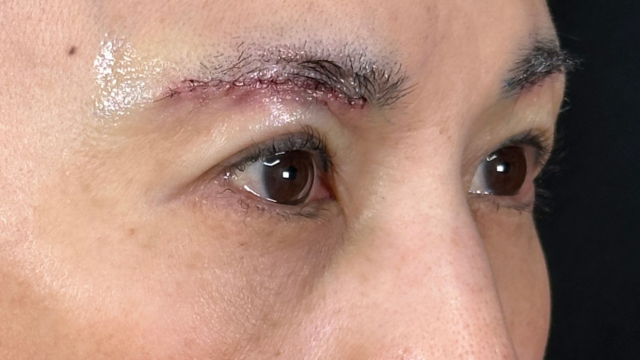 手術前の状態 その1