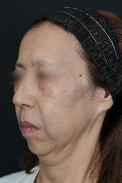 手術前の状態 その1