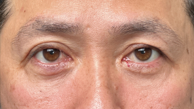 手术前的状态 其一