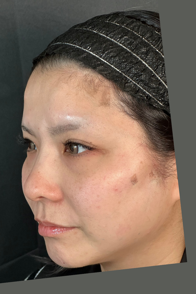 手术前的状态 其一