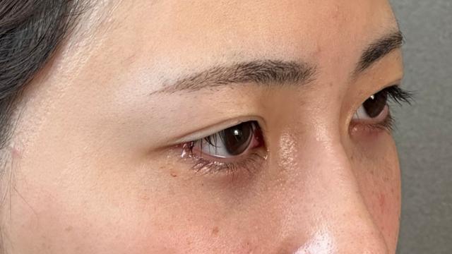 Postoperative Condition Part 1