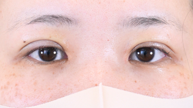 Postoperative Condition Part 1