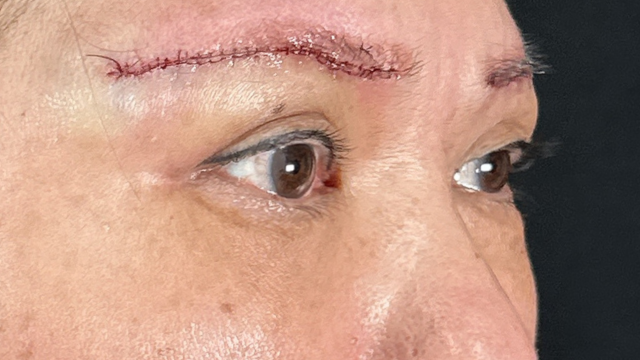 Postoperative Condition Part 1