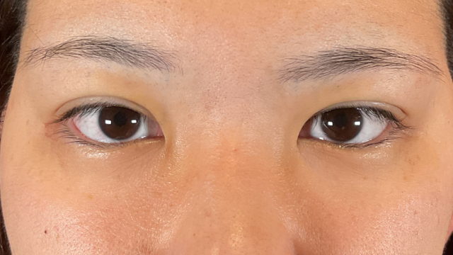 手术前的状态 其一