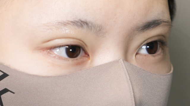 手术前的状态 其一