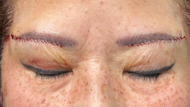 Postoperative Condition Part 1