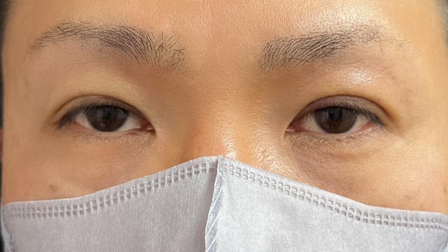 手术前的状态 其一