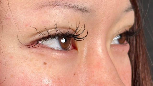 手术前的状态 其一