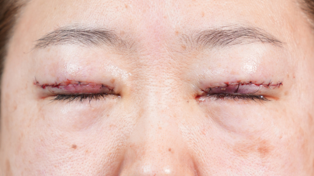 Postoperative Condition Part 1