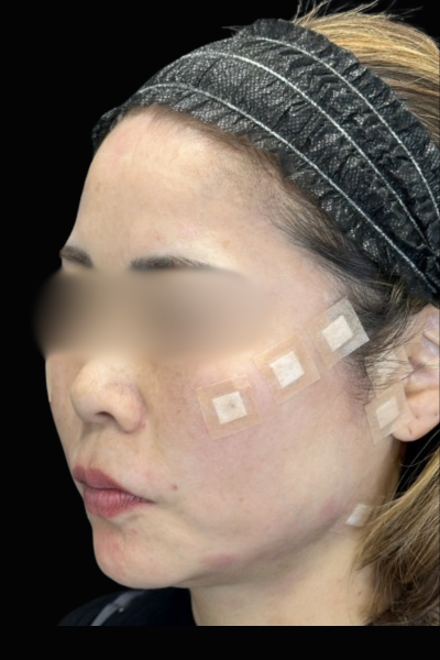 手術前の状態 その1