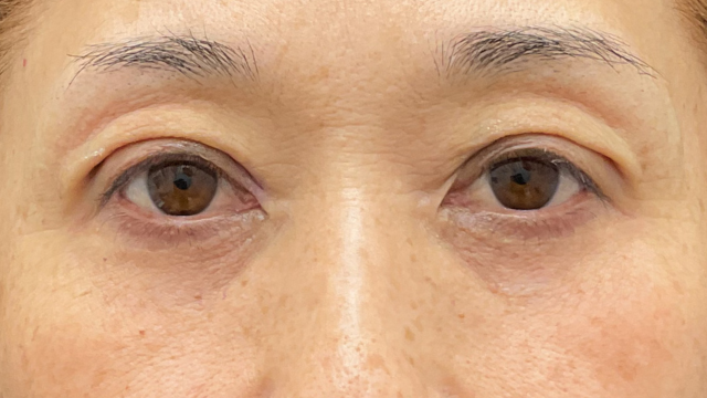 手术前的状态 其一