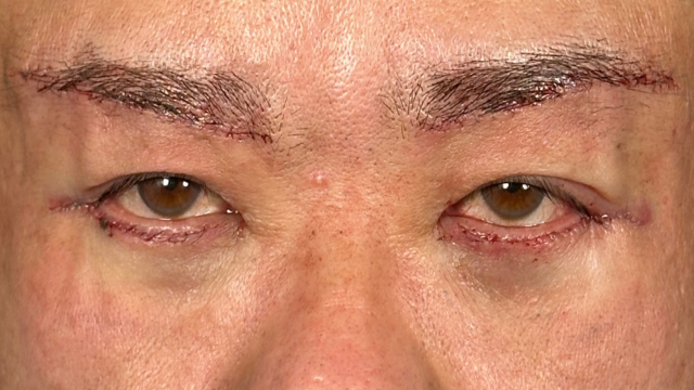 Postoperative Condition Part 1