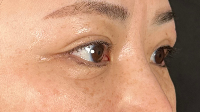 手术前的状态 其一