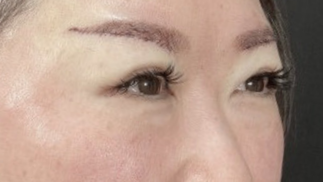 Postoperative Condition Part 1