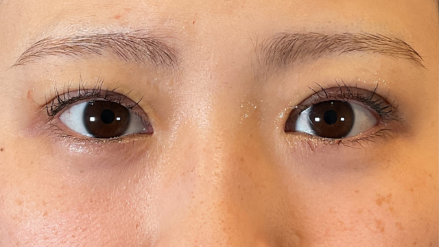 手术前的状态 其一