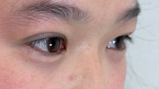 手术前的状态 其一