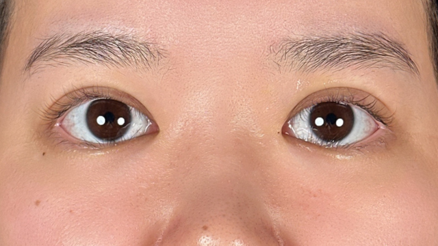 手术前的状态 其一