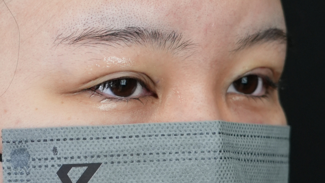 手术前的状态 其一