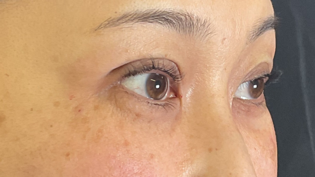 手术前的状态 其一