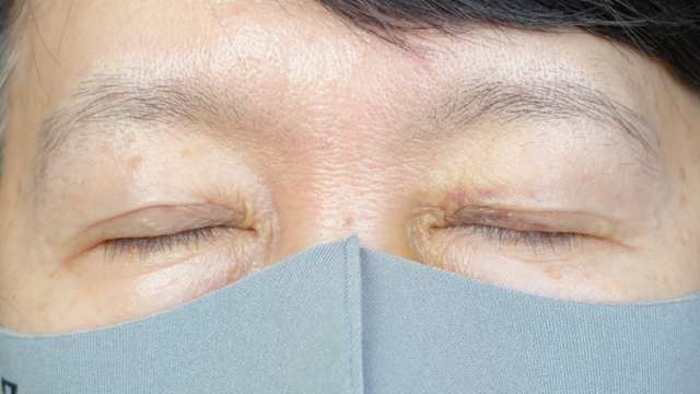 手术前的状态 其一