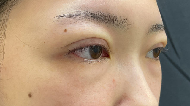 Postoperative Condition Part 1