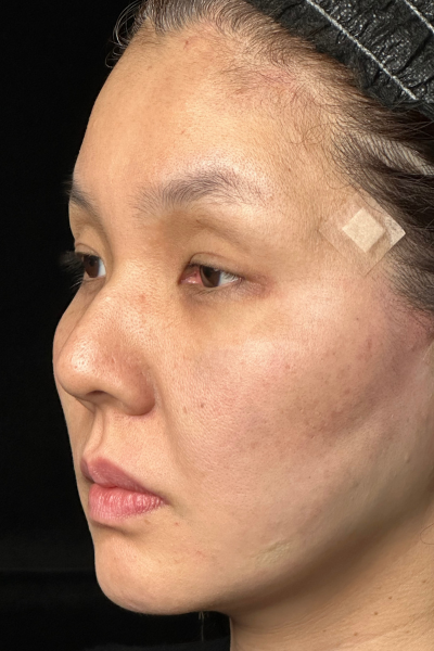 手術前の状態 その1