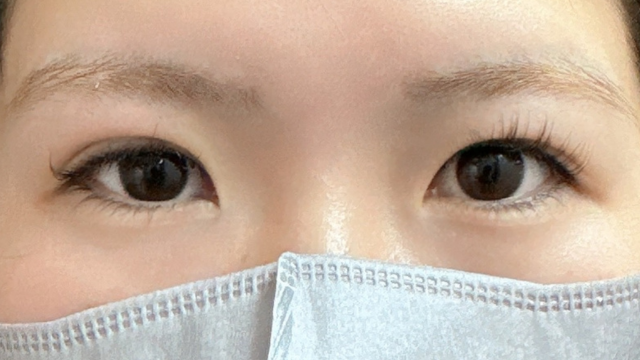 手术前的状态 其一