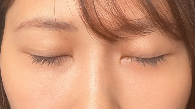 Postoperative Condition Part 1