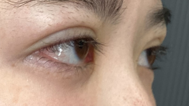 手术前的状态 其一