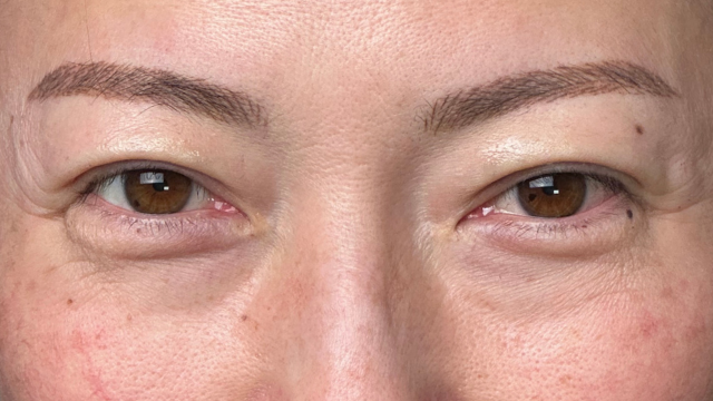 手术前的状态 其一