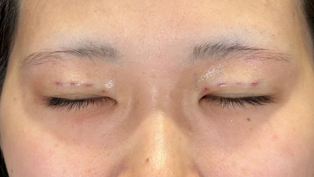 手術前の状態 その1