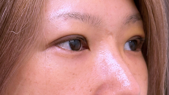 Postoperative Condition Part 1