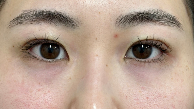 手术前的状态 其一