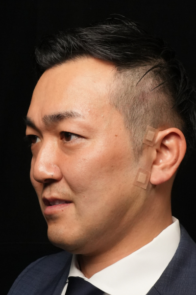 手術前の状態 その1