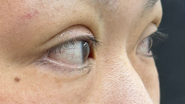 手術前の状態 その1