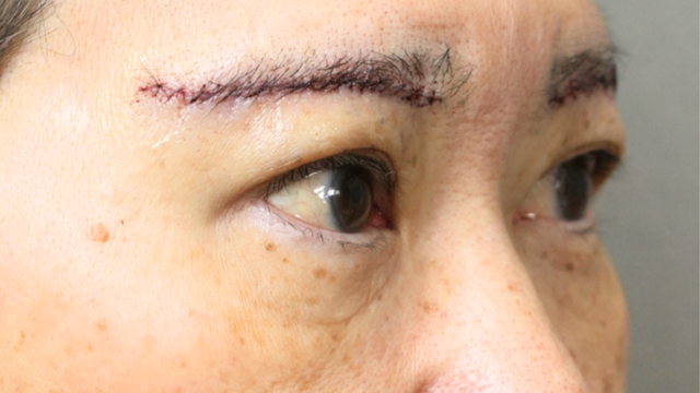 Postoperative Condition Part 1