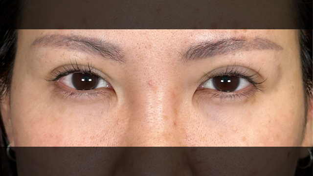 Postoperative Condition Part 1