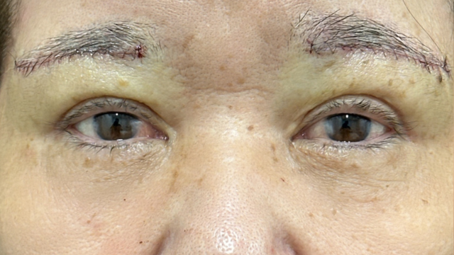 手术前的状态 其一