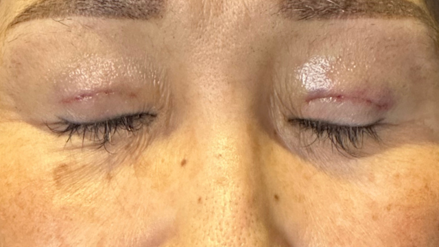 手术前的状态 其一