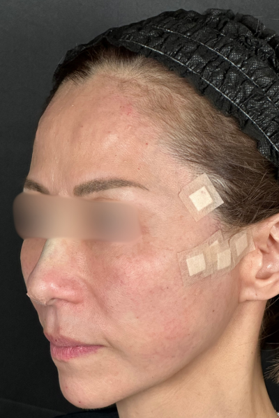 手術前の状態 その1