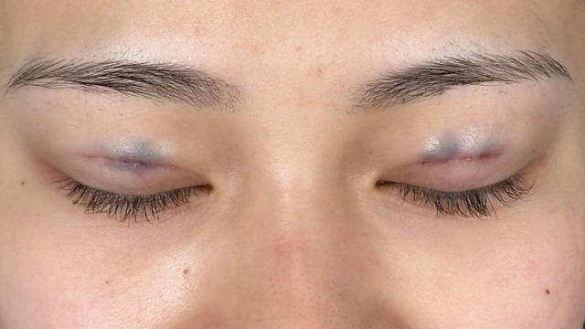 手术前的状态 其一