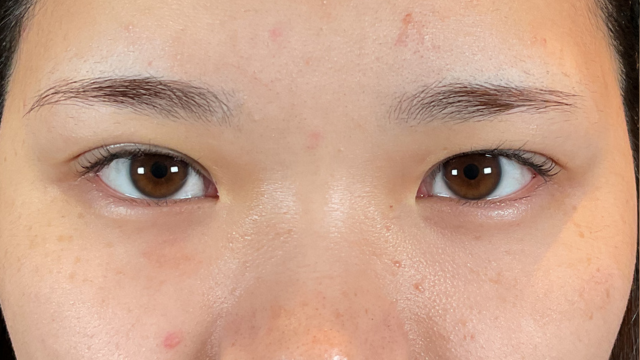 手術前の状態 その1