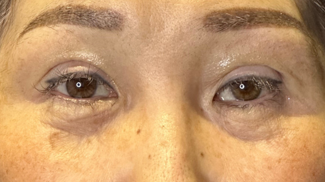 手术前的状态 其一