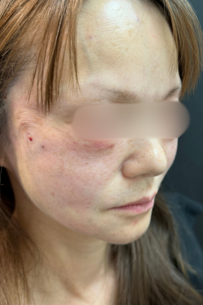 手術前の状態 その1