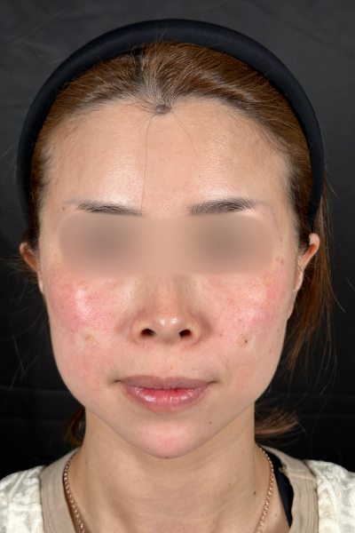 手术前的状态 其一