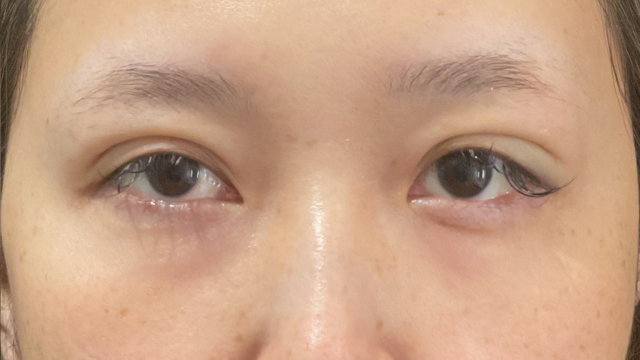 手术前的状态 其一