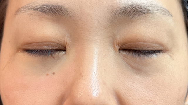 Postoperative Condition Part 1