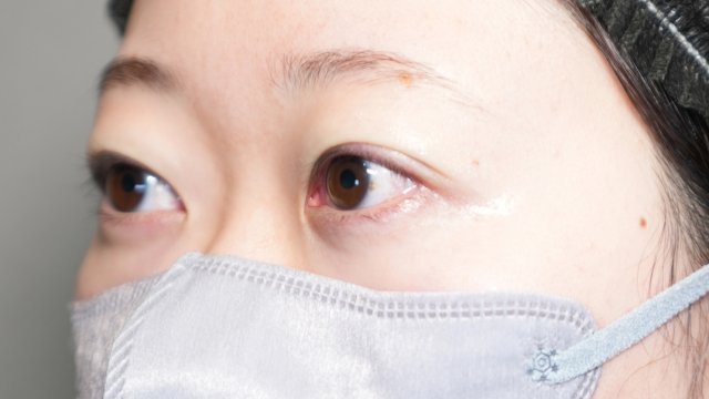 手術前の状態 その1