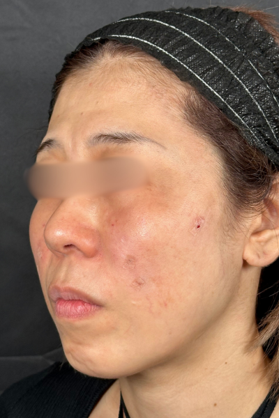 手術前の状態 その1